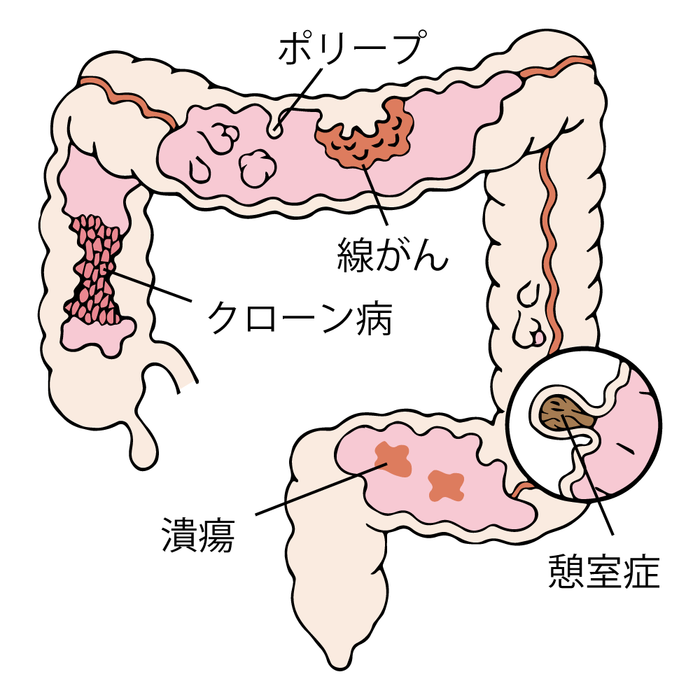 大腸